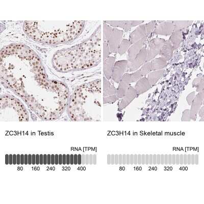 Immunohistochemistry-Paraffin: ZC3H14 Antibody [NBP2-49087]