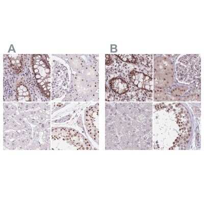 Immunohistochemistry-Paraffin: ZC3H14 Antibody [NBP2-49087]