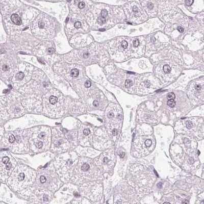 Immunohistochemistry-Paraffin: ZC3H14 Antibody [NBP2-49087]