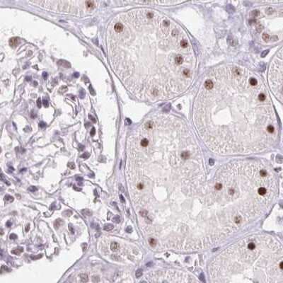 Immunohistochemistry-Paraffin: ZC3H14 Antibody [NBP2-49087]