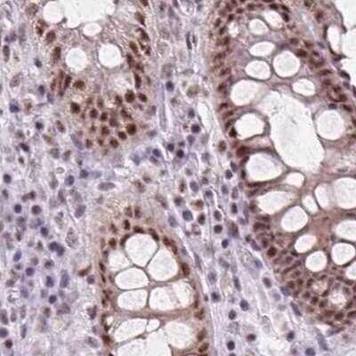Immunohistochemistry-Paraffin: ZC3H14 Antibody [NBP2-49087]