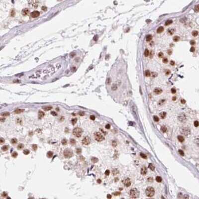 Immunohistochemistry-Paraffin: ZC3H14 Antibody [NBP2-49087]