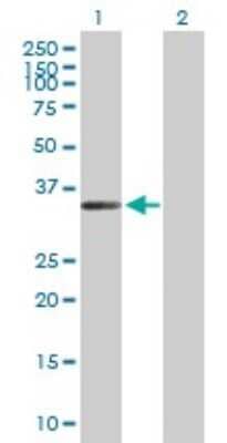 Western Blot: ZC3H14 Antibody [H00079882-B01P]