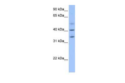 Western Blot: ZC3H14 Antibody [NBP1-56914]