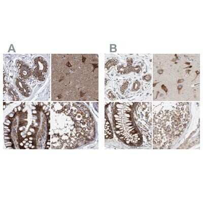 Immunohistochemistry-Paraffin: ZC3H15 Antibody [NBP1-81312]