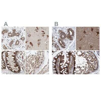 Immunohistochemistry-Paraffin: ZC3H15 Antibody [NBP1-81314]