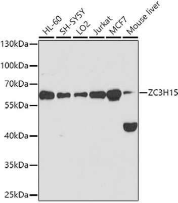 Western Blot: ZC3H15 AntibodyBSA Free [NBP2-94541]