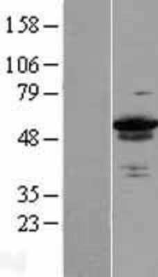 Western Blot: ZC3H15 Overexpression Lysate [NBL1-17983]