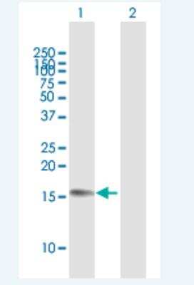 Western Blot: ZC3H18-AS1 Antibody [H00400555-B01P-50ug]