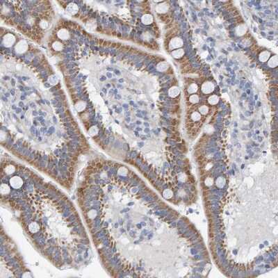 Immunohistochemistry-Paraffin: ZC3H3 Antibody [NBP1-81536]