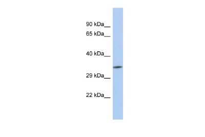 Western Blot: ZC3H3 Antibody [NBP2-88610]