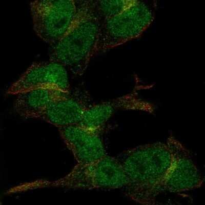 Immunocytochemistry/ Immunofluorescence: ZC3H6 Antibody [NBP2-69012]