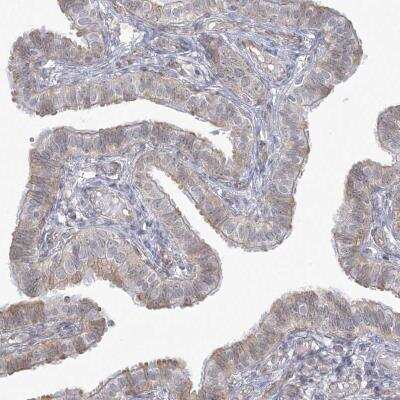 Immunohistochemistry: ZC3H6 Antibody [NBP1-81909]