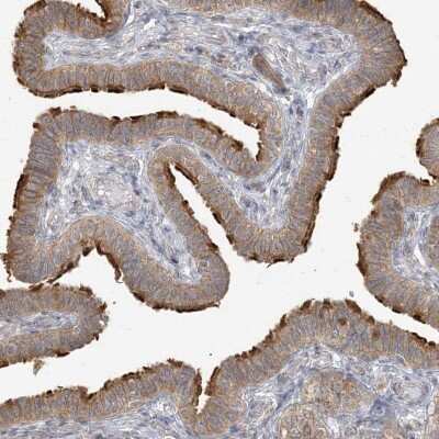 Immunohistochemistry-Paraffin: ZC3H6 Antibody [NBP2-38275]