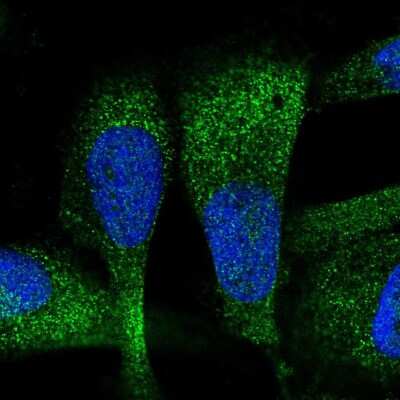 Immunocytochemistry/ Immunofluorescence: ZC3H7A Antibody [NBP2-56811]