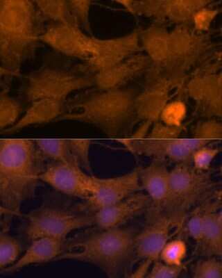 Immunocytochemistry/ Immunofluorescence: ZC3H7A Antibody - Azide and BSA Free [NBP2-93195]