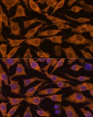 Immunocytochemistry/ Immunofluorescence: ZC3H7A Antibody - Azide and BSA Free [NBP2-93195]