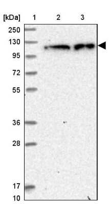 Western Blot: ZC3H7A Antibody [NBP1-82187]