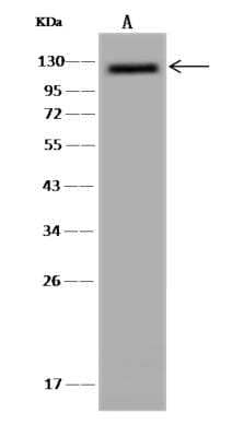 Western Blot: ZC3H7A Antibody [NBP3-06301]