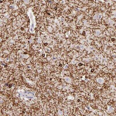 Immunohistochemistry-Paraffin: ZC3H7B Antibody [NBP1-85115]