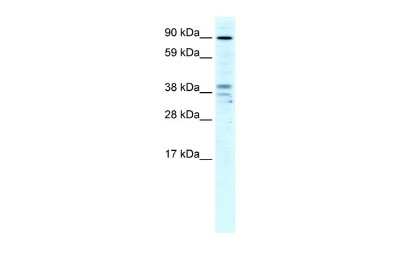 Western Blot: ZC3H7B Antibody [NBP2-83793]