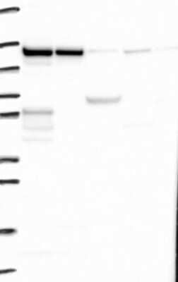 Western Blot: ZC3H7B Antibody [NBP3-17458]