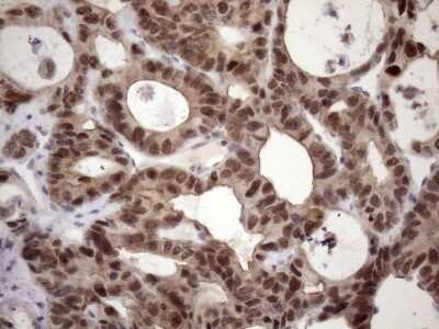 Immunohistochemistry: ZC3H8 Antibody (OTI4H5) [NBP2-46397]