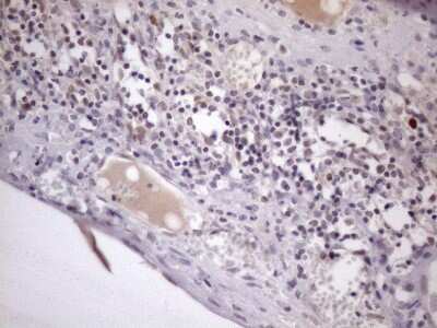 Immunohistochemistry: ZC3H8 Antibody (OTI4H5) [NBP2-46397]