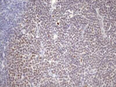 Immunohistochemistry: ZC3H8 Antibody (OTI4H5) [NBP2-46397]