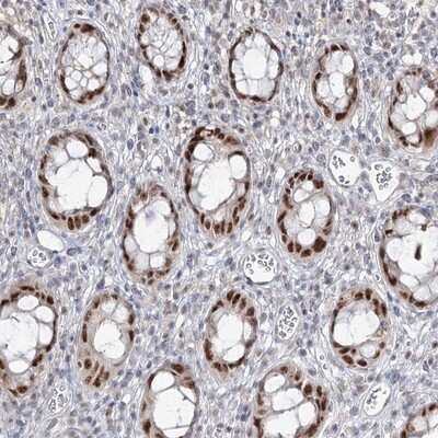 Immunohistochemistry-Paraffin: ZC3H8 Antibody [NBP1-84661]
