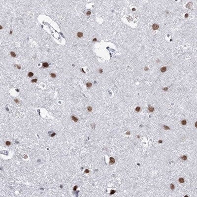 Immunohistochemistry-Paraffin: ZC3H8 Antibody [NBP2-33980]