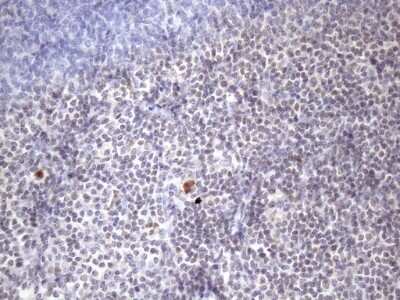 Immunohistochemistry: ZC3H8 Antibody (OTI4H5) - Azide and BSA Free [NBP2-74908]