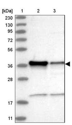 Western Blot: ZC3H8 Antibody [NBP1-84661]