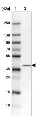 Western Blot: ZC3H8 Antibody [NBP2-33980]