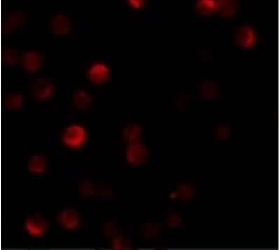 Immunocytochemistry/ Immunofluorescence: ZCCHV Antibody - BSA Free [NBP1-77184]