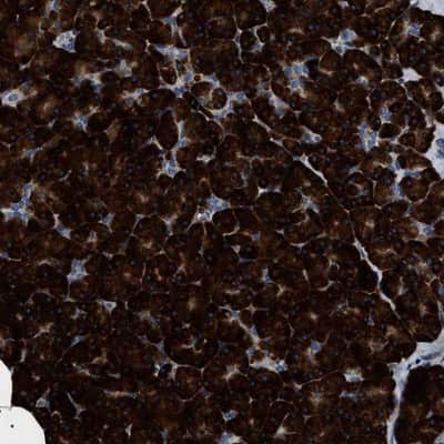 Immunohistochemistry-Paraffin: ZC3HAV1L Antibody [NBP1-86726]
