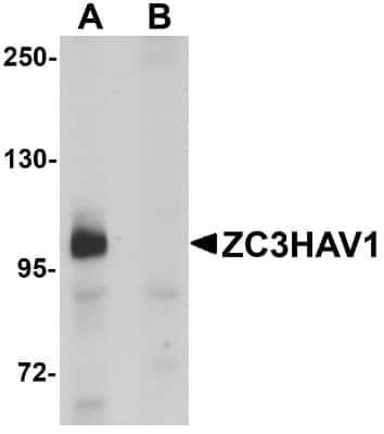 Western Blot: ZCCHV AntibodyBSA Free [NBP1-77184]