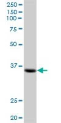 Western Blot: ZC4H2 Antibody [H00055906-B01P]