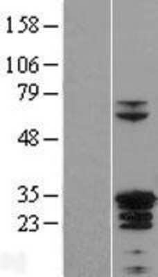 Western Blot: ZC4H2 Overexpression Lysate [NBP2-06786]