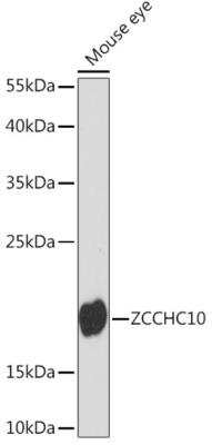 Western Blot: ZCCHC10 AntibodyAzide and BSA Free [NBP2-94623]