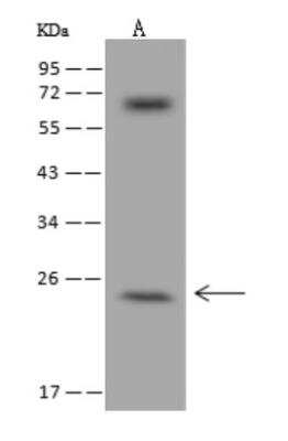 Western Blot: ZCCHC10 Antibody [NBP3-06032]