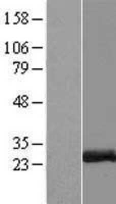 Western Blot: ZCCHC10 Overexpression Lysate [NBP2-06955]