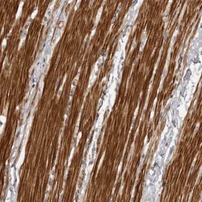 Immunohistochemistry-Paraffin: ZCCHC11/TUT4 Antibody [NBP1-83026]