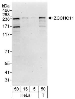 Western Blot: ZCCHC11/TUT4 Antibody [NBP1-42654]