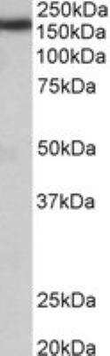 Western Blot: ZCCHC11/TUT4 Antibody [NBP2-27539]