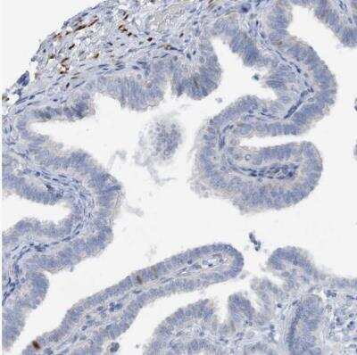 Immunohistochemistry-Paraffin: ZCCHC12 Antibody [NBP1-83675]