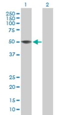 Western Blot: ZCCHC12 Antibody [H00170261-B01P]