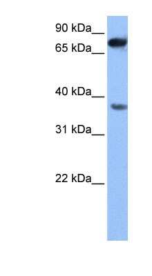 Western Blot: ZCCHC12 Antibody [NBP1-54808]