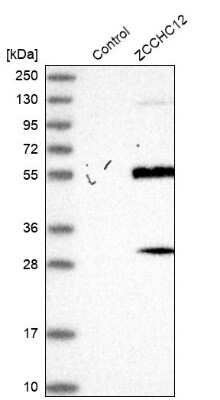 Western Blot: ZCCHC12 Antibody [NBP2-33943]