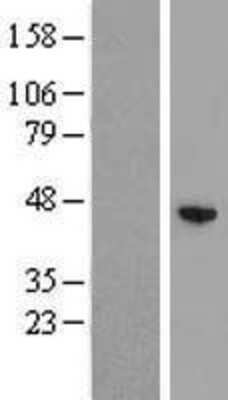 Western Blot: ZCCHC12 Overexpression Lysate [NBL1-17989]